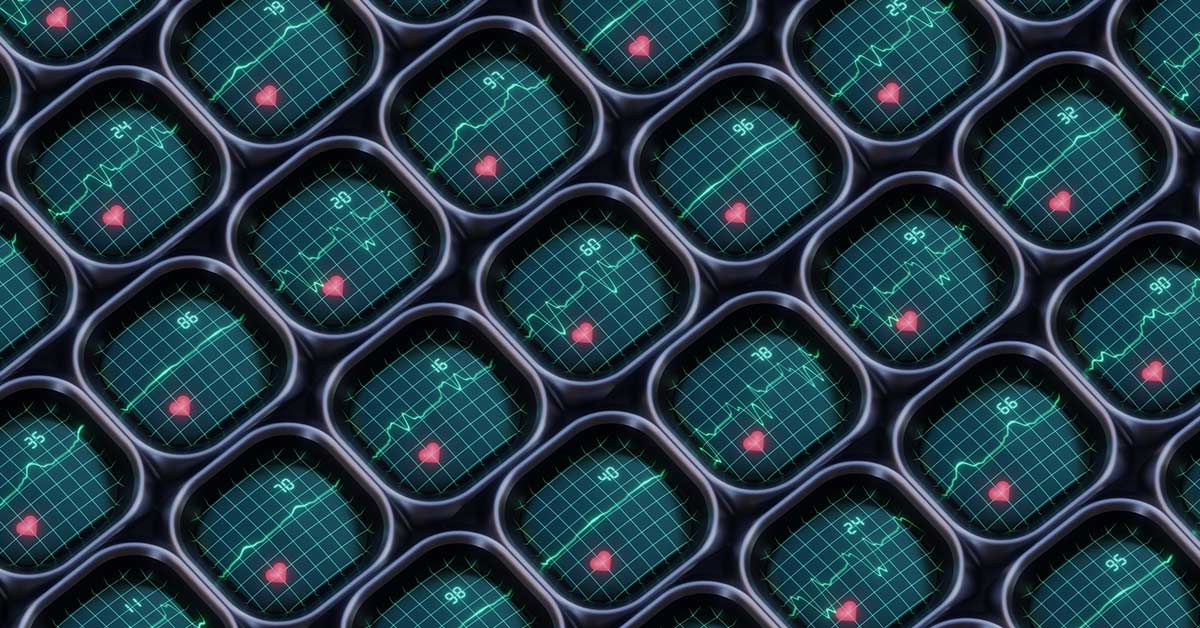 Multiple heart monitors