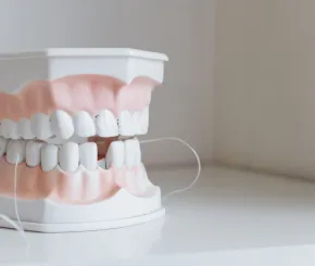 An image of model teeth with one tooth missing
